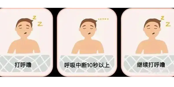 你真的了解睡眠呼吸暫停嗎？6600萬中重度患者正在受害！—仟龍醫(yī)療