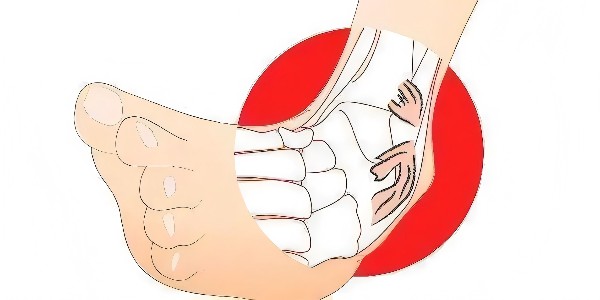 踝關(guān)節(jié)扭傷后的最佳應(yīng)對指南：簡單四步，助力快速康復！